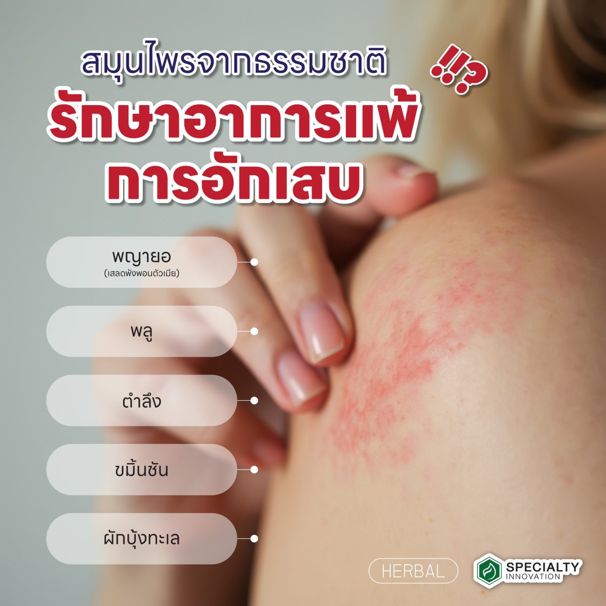 🌿 สมุนไพรจากธรรมชาติ ช่วยบรรเทาอาการแพ้และการอักเสบ